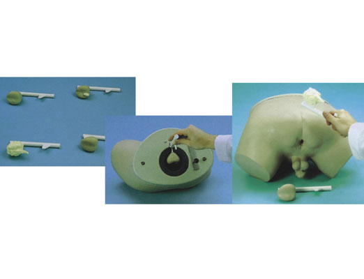 ǰ���ٙz��ģ��