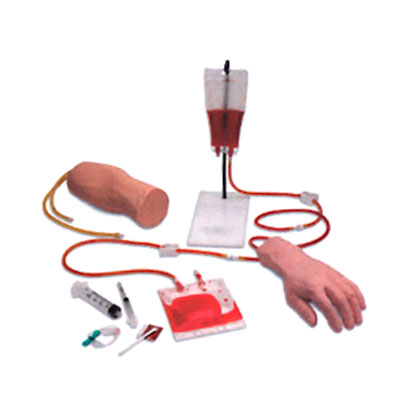 �ֲ����ⲿ�M��ʽ�o�}ݔҺ��Ѫ��Ӗ(x��n)��ģ��